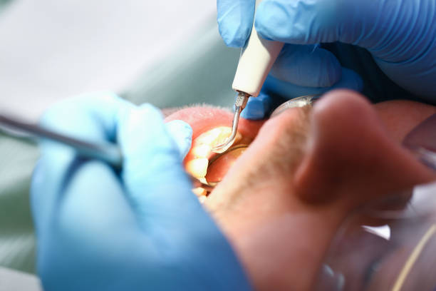 Best Emergency TMJ Treatment in Millbury, OH